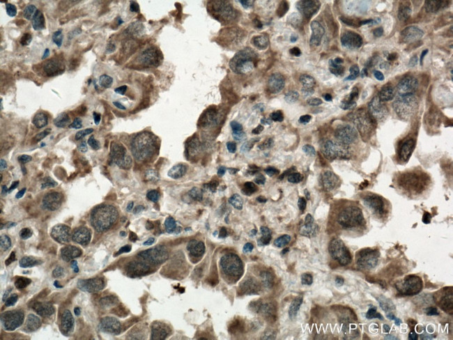 BAX Antibody in Immunohistochemistry (Paraffin) (IHC (P))