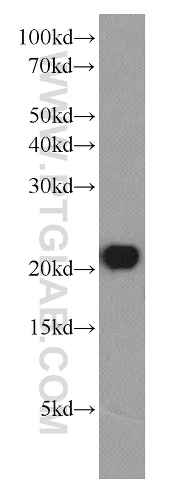 BAX Antibody in Western Blot (WB)