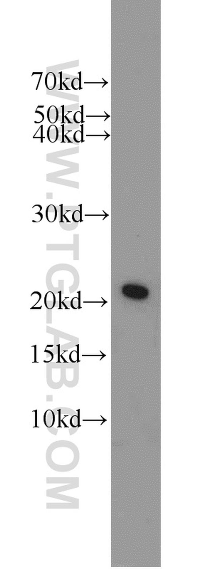 BAX Antibody in Western Blot (WB)