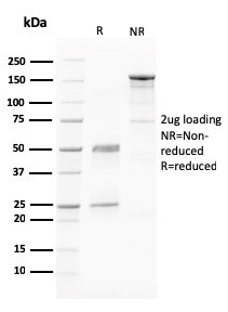 PAPP-A/Pappalysin-1 (Marker of Atherosclerosis and Aneuploid Fetus) Antibody in SDS-PAGE (SDS-PAGE)