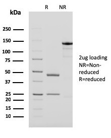 PAPP-A/Pappalysin-1 (Marker of Atherosclerosis and Aneuploid Fetus) Antibody in SDS-PAGE (SDS-PAGE)