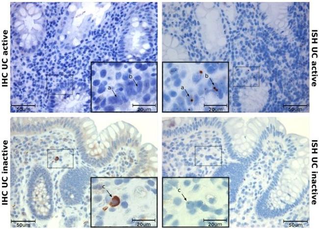 CCR6 Antibody in Immunohistochemistry (IHC)