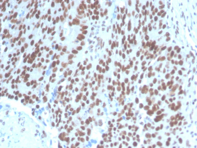 PAX2 (Renal Cell and Ovarian Carcinoma Marker) Antibody in Immunohistochemistry (Paraffin) (IHC (P))