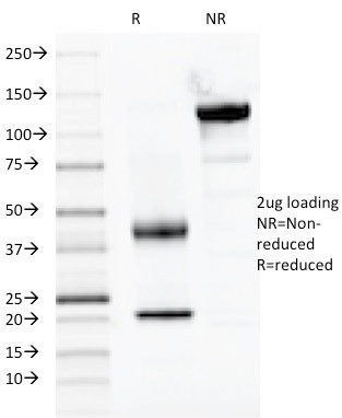 PAX2 (Renal Cell and Ovarian Carcinoma Marker) Antibody in SDS-PAGE (SDS-PAGE)