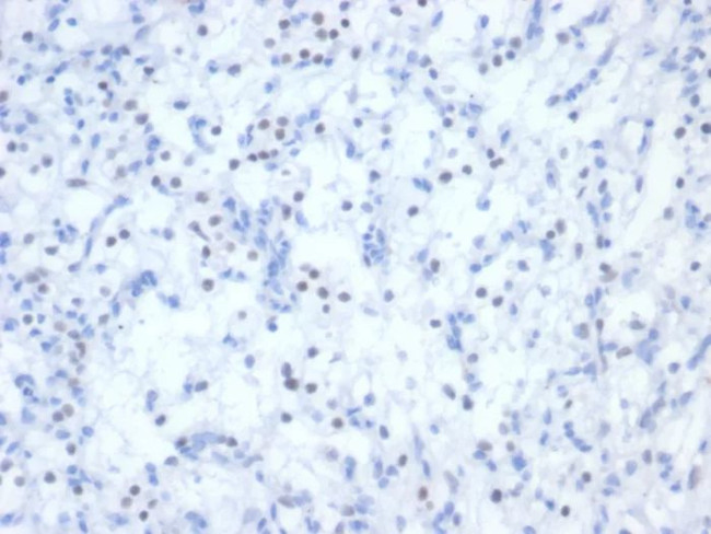 PAX2 (Renal Cell and Ovarian Carcinoma Marker) Antibody in Immunohistochemistry (Paraffin) (IHC (P))