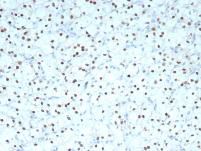 PAX2 (Renal Cell and Ovarian Carcinoma Marker) Antibody in Immunohistochemistry (Paraffin) (IHC (P))