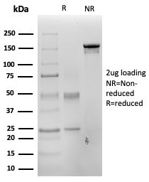 PAX3 Antibody in SDS-PAGE (SDS-PAGE)