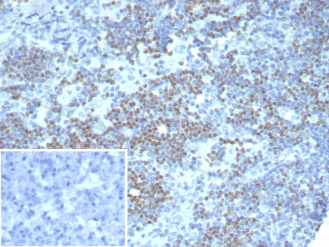 PAX3 Antibody in Immunohistochemistry (Paraffin) (IHC (P))