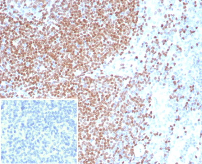 PAX3 Antibody in Immunohistochemistry (Paraffin) (IHC (P))