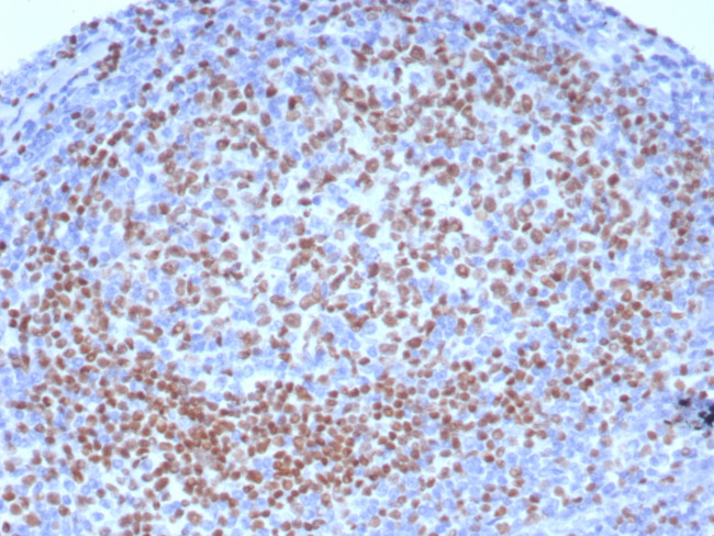 PAX5/BSAP (Early B-Cell Marker) Antibody in Immunohistochemistry (Paraffin) (IHC (P))