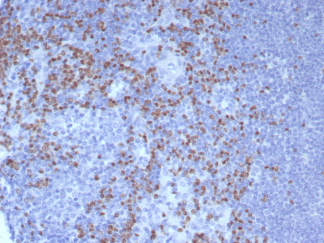 PAX5/BSAP (Early B-Cell Marker) Antibody in Immunohistochemistry (Paraffin) (IHC (P))