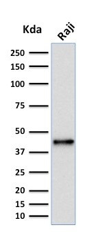 PAX5/BSAP (Early B-Cell Marker) Antibody in Western Blot (WB)