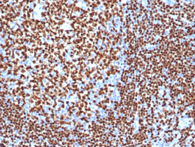 PAX5/BSAP Antibody in Immunohistochemistry (Paraffin) (IHC (P))