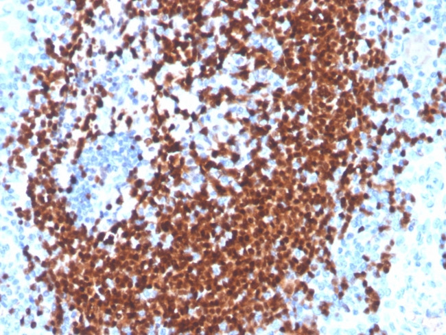 PAX5/BSAP Antibody in Immunohistochemistry (Paraffin) (IHC (P))