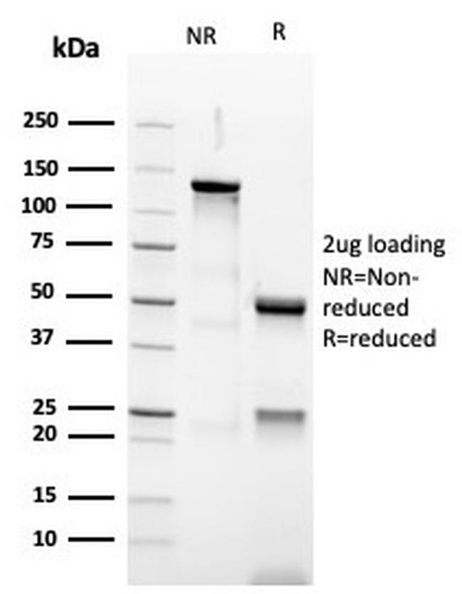 PAX5/BSAP Antibody in SDS-PAGE (SDS-PAGE)