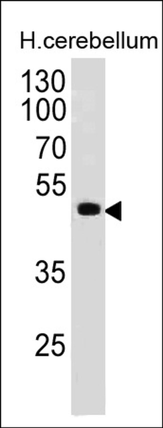 PAX6 Antibody in Western Blot (WB)
