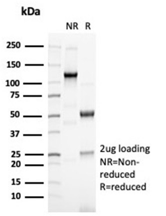 PAX6 (Stem Cell Marker) Antibody in SDS-PAGE (SDS-PAGE)
