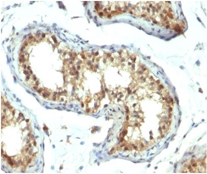 PAX7 (Rhabdomyosarcoma Marker) Antibody in Immunohistochemistry (Paraffin) (IHC (P))