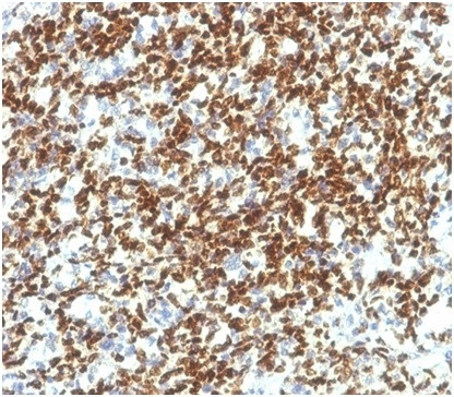 PAX7 (Rhabdomyosarcoma Marker) Antibody in Immunohistochemistry (Paraffin) (IHC (P))