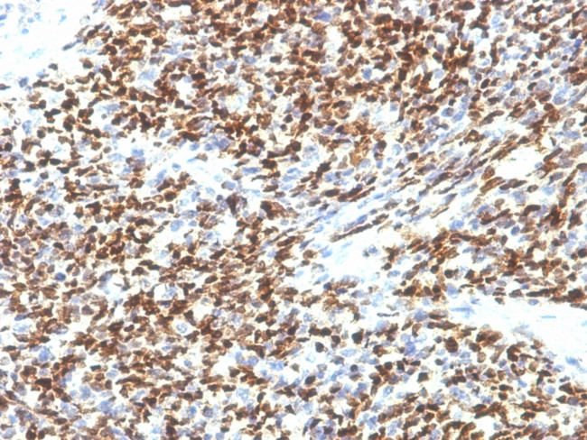 PAX7 (Rhabdomyosarcoma Marker) Antibody in Immunohistochemistry (Paraffin) (IHC (P))