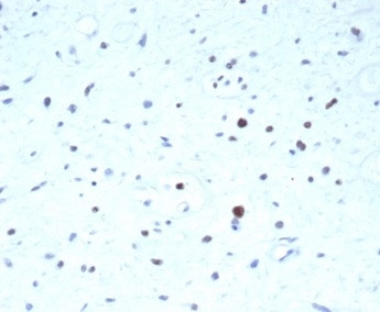 PAX7 (Rhabdomyosarcoma Marker) Antibody in Immunohistochemistry (Paraffin) (IHC (P))