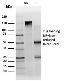 PBX1/PRL (Transcription Factor) Antibody in SDS-PAGE (SDS-PAGE)