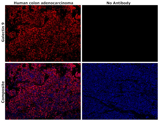 Galectin 9 Antibody in Immunohistochemistry (Paraffin) (IHC (P))