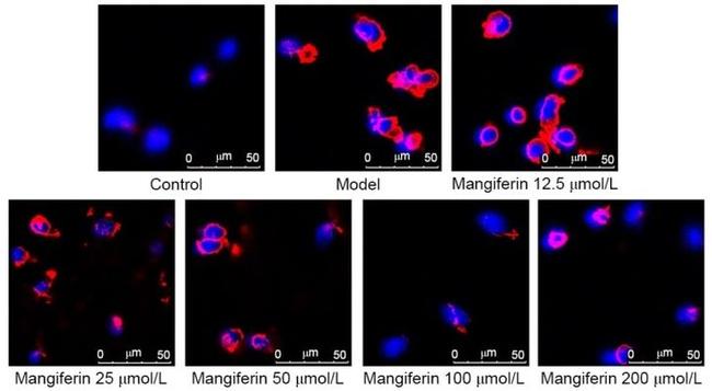 IRF5 Antibody in Immunocytochemistry (ICC/IF)