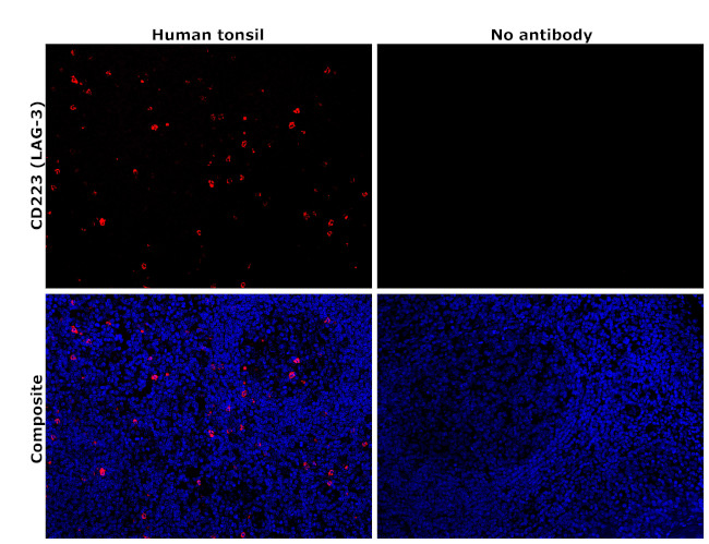 CD223 (LAG-3) Antibody in Immunohistochemistry (Paraffin) (IHC (P))