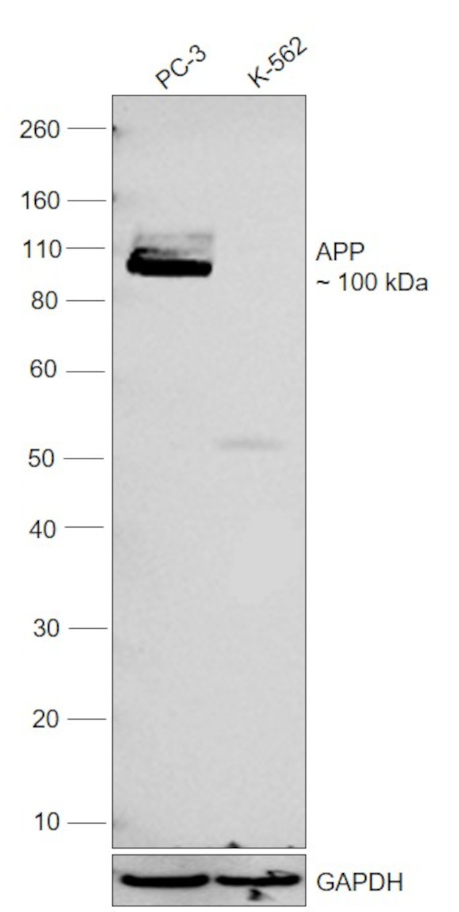 beta Amyloid Antibody