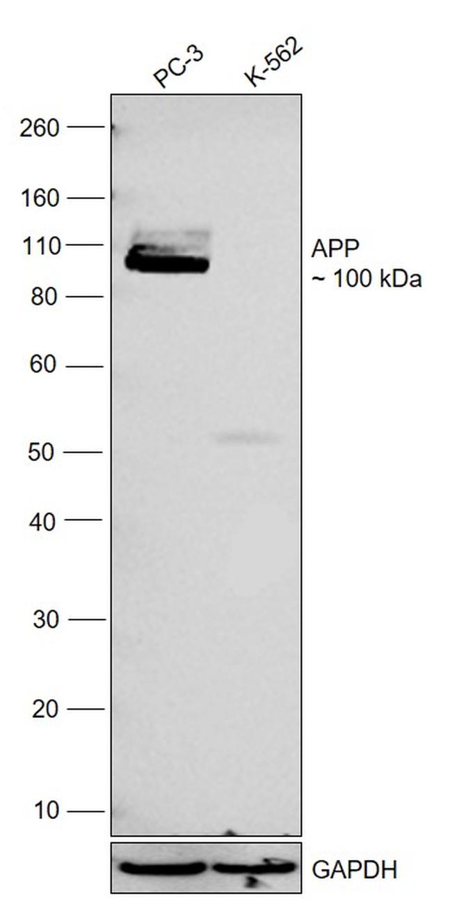 beta Amyloid Antibody in Western Blot (WB)