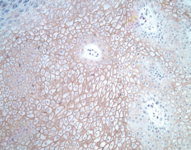 Claudin 1 Antibody in Immunohistochemistry (IHC)