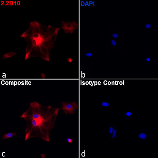 GFAP Antibody in Immunocytochemistry (ICC/IF)