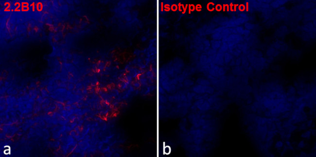 GFAP Antibody in Immunohistochemistry (Frozen) (IHC (F))