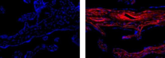 Collagen IV Antibody in Immunohistochemistry (Paraffin) (IHC (P))