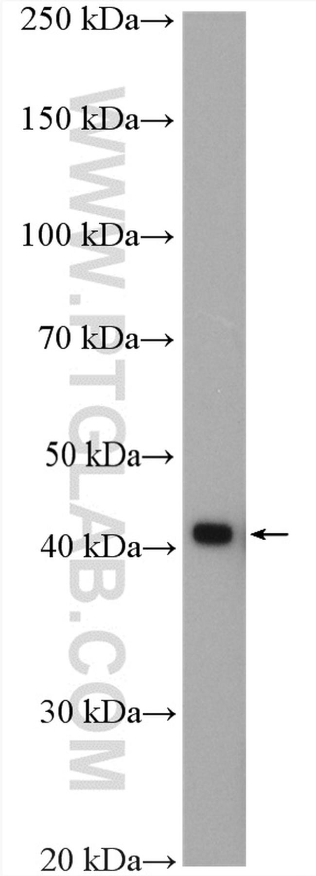 IST1 Antibody in Western Blot (WB)