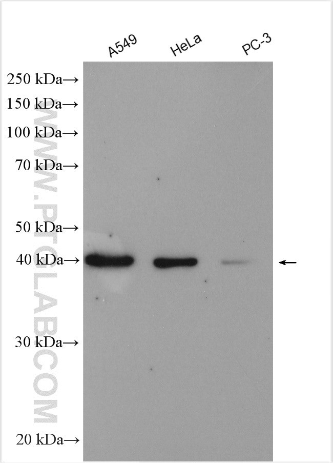 IST1 Antibody in Western Blot (WB)