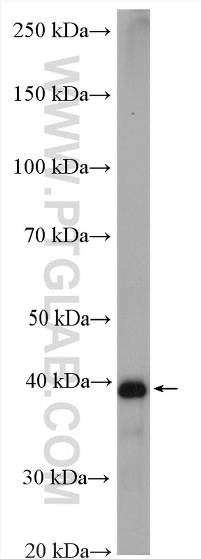 IST1 Antibody in Western Blot (WB)