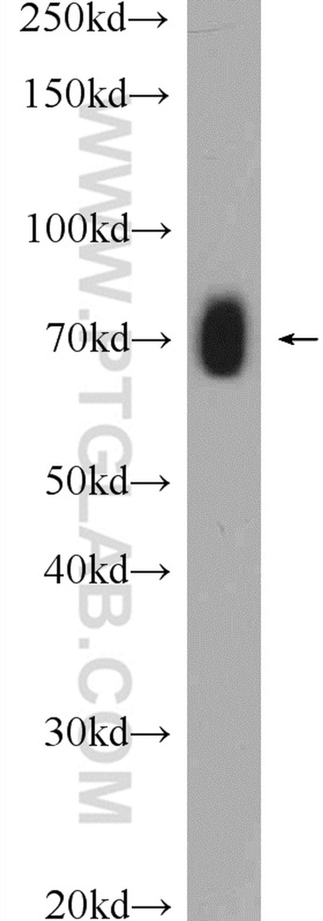 GEFT Antibody in Western Blot (WB)