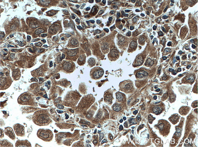 DUSP22 Antibody in Immunohistochemistry (Paraffin) (IHC (P))