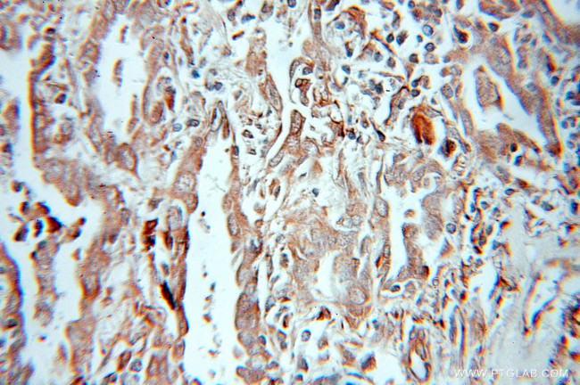 DUSP22 Antibody in Immunohistochemistry (Paraffin) (IHC (P))