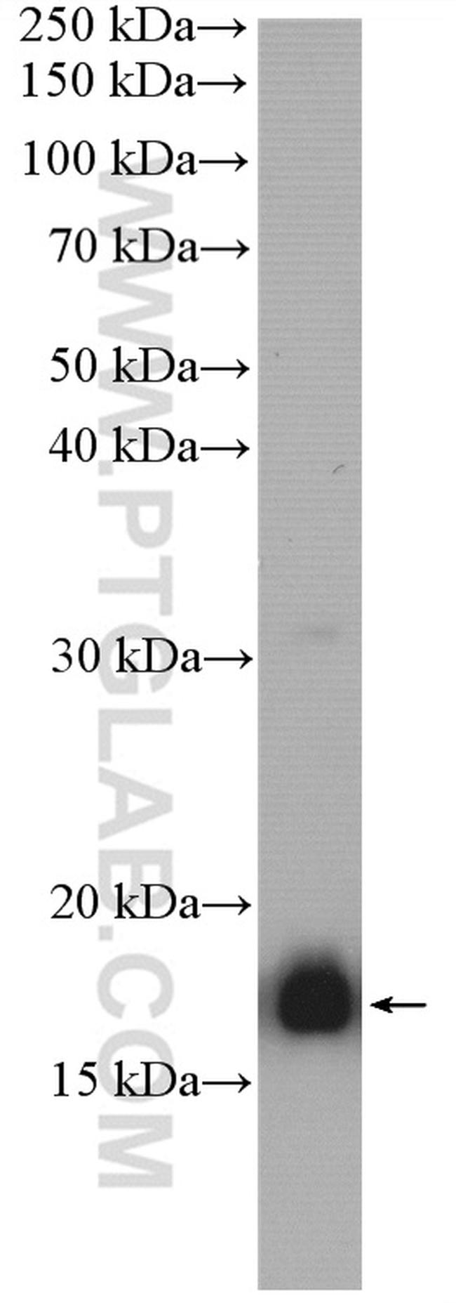 PTRH2 Antibody in Western Blot (WB)