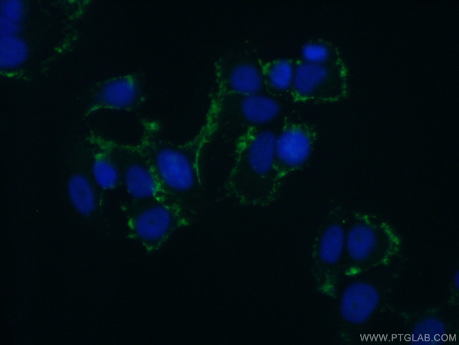 ABCB6 Antibody in Immunocytochemistry (ICC/IF)