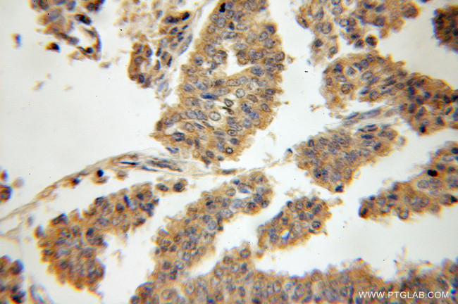 ABCB6 Antibody in Immunohistochemistry (Paraffin) (IHC (P))