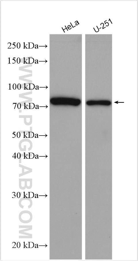 ABCB6 Antibody in Western Blot (WB)