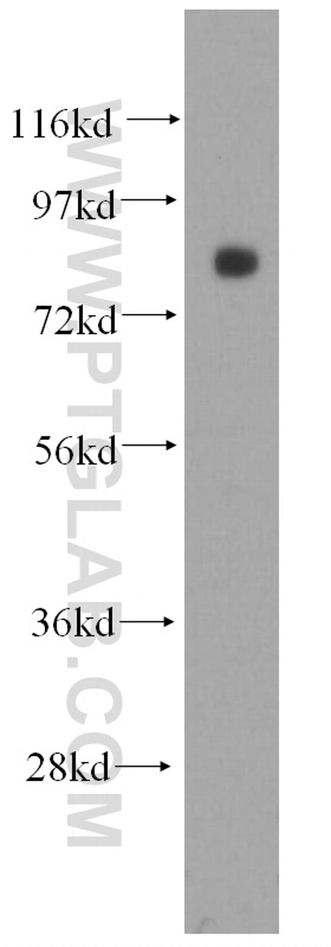 ABCB6 Antibody in Western Blot (WB)