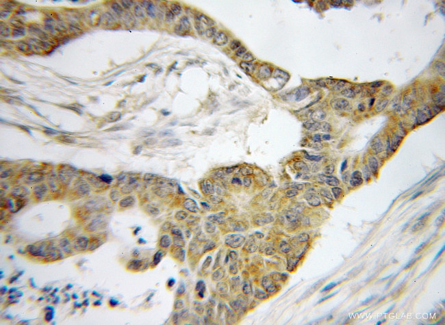 BRD7 Antibody in Immunohistochemistry (Paraffin) (IHC (P))