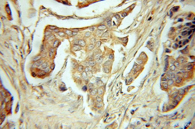 FABP7 Antibody in Immunohistochemistry (Paraffin) (IHC (P))