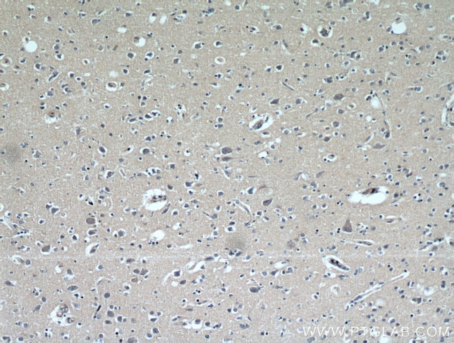 FABP7 Antibody in Immunohistochemistry (Paraffin) (IHC (P))