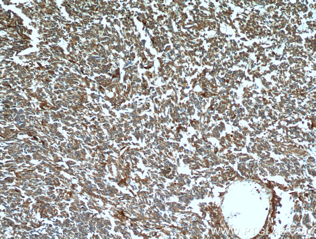 FABP7 Antibody in Immunohistochemistry (Paraffin) (IHC (P))